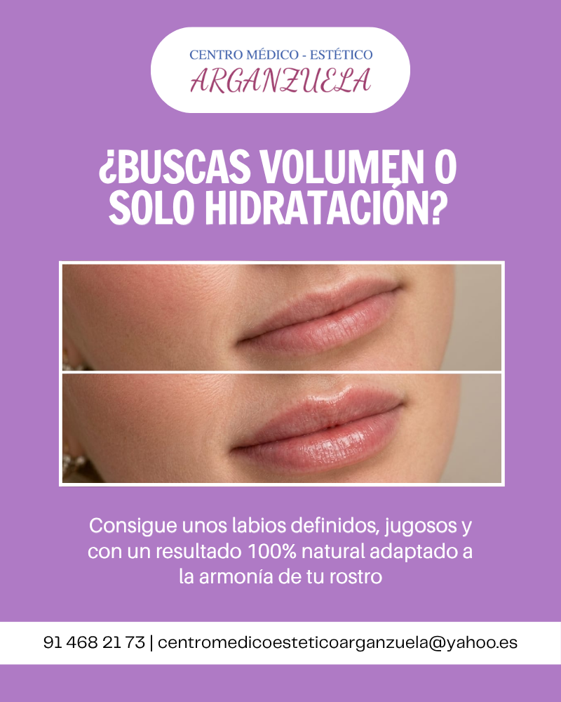 arganzuela pop up